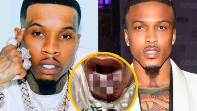 August Alsina Shows Injuries And Bloody From Alleged Fight With Tory Lanez - WhatsOnRap August Alsina Shows Injuries And Bloody From Alleged Fight With Tory Lanez