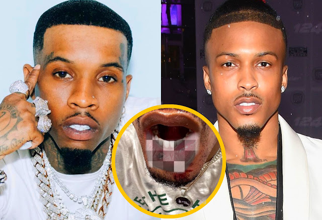August Alsina Shows Injuries And Bloody From Alleged Fight With Tory Lanez