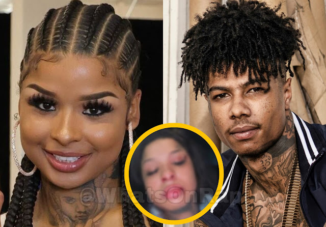 Chrisean Rock Goes Live, Shows Busted Lip/Bruised Eye and Accuses Blueface of Beating Her Up