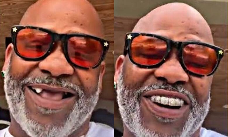 Dame Dash’s Grills Fall Out During Instagram Rant About 50 Cent