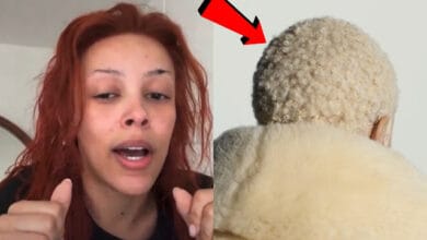 Doja Cat Takes Aim at Fans Who Think Her New Cover Art Is a Pubic Hair Photo: "Comparing 4C hair to...ugh, pubic hair? Really?" Doja Cat Addresses Hair Criticism in New Cover Art: Calls for Progress