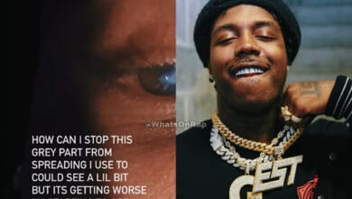 EST Gee Reveals He’s Losing His Vision in One Eye, Asks for Help - WhatsOnRap EST Gee reveals he is losing vision in one of his eyes
