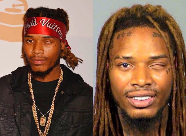 The Tragic Fall Of Fetty Wap. How He Became Broke And Forgotten